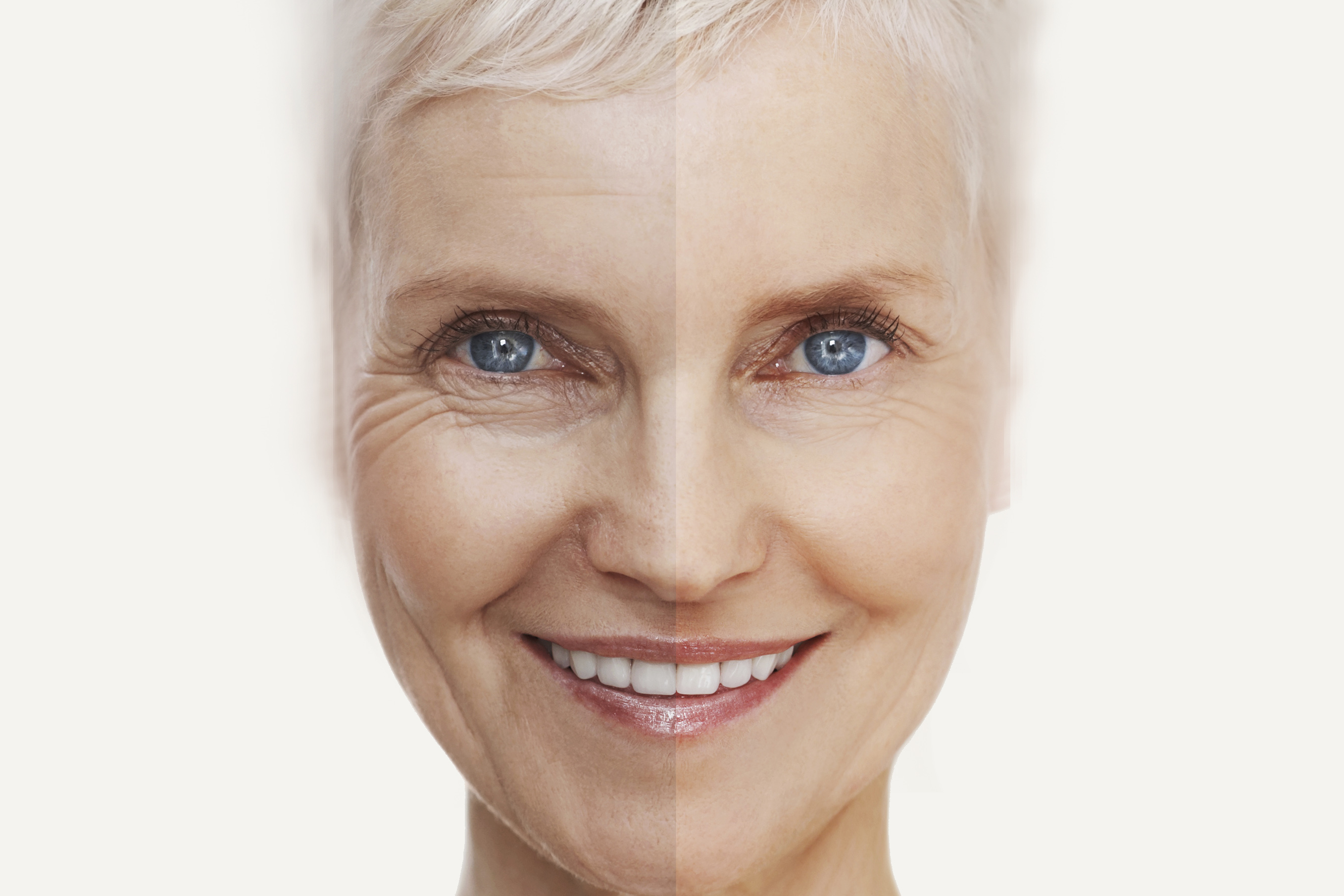 Dr Eros anti-wrinkle fillers botox